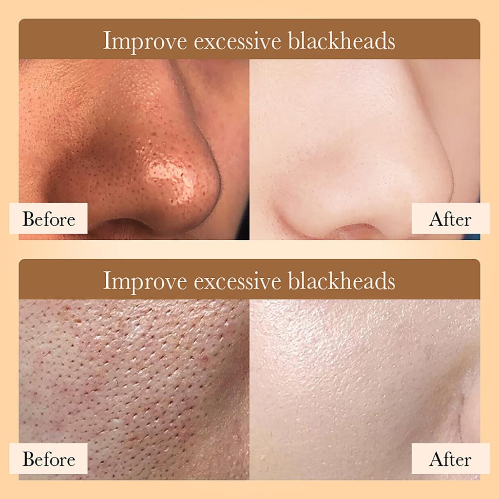 Маска-стик из рисового пюре и грязи Детокс- и увлажняющая маска для лица для глубокого очищения