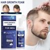 Minodil Men's Hair Regeneration Care Minodil And Biotin Help  Sparse Hair And  Male Hair Loss Care