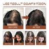 Pure Batana Oil for Hair Growth, Natural Batana Butter Treatment for Alopecia Areata & Hair Loss, Hair Regrowth Serum for Men & Women