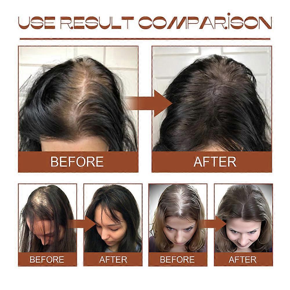 Pure Batana Oil for Hair Growth, Natural Batana Butter Treatment for Alopecia Areata & Hair Loss, Hair Regrowth Serum for Men & Women