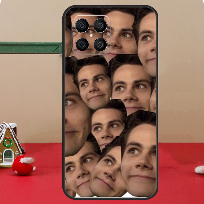 Коллаж Дилан О'Брайен Волк-одиночка Чехол Для Honor Magic 8 Pro 6 7 Lite Honor 400 200 50 70 X8c X8b X9a X9b X9c X9d Win RT Чехол