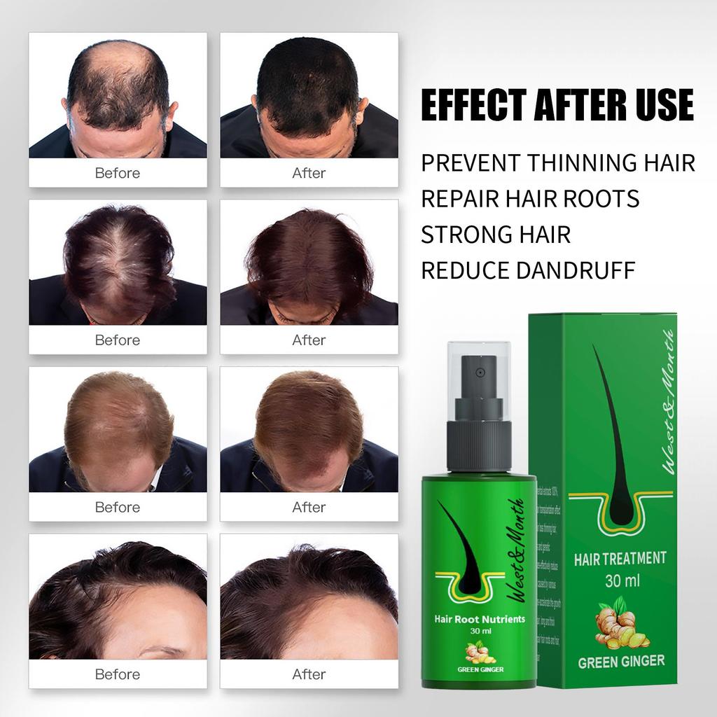 West&Month Спрей для ухода за волосами с имбирем, укрепляет волосы, предотвращает истончение, пушистость, восстанавливает корни волос, уменьшает перхоть и помогает предотвратить выпадение волос 30 мл