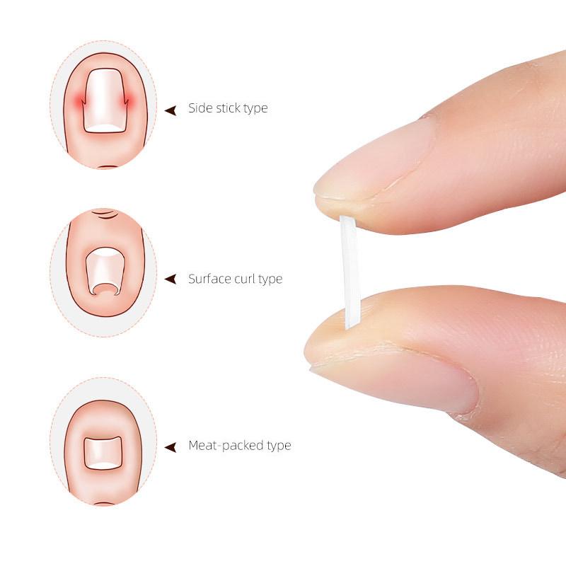 Крючок для ухода за вросшими ногтями, двухсторонний, для коррекции вросших пальцев ног, пилка для маникюра и педикюра, инструмент для ухода за чистыми ногтями ног