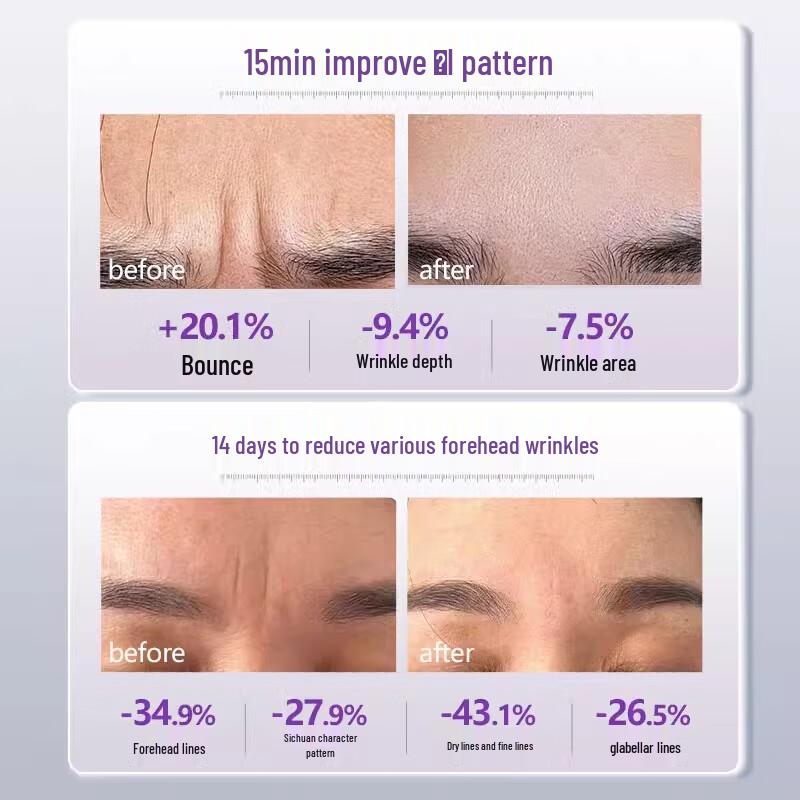 Tao Zhi Yao Yao Патчи от морщин для лба и межбровья