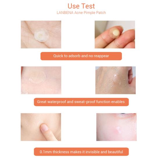 2 Packs Tea Tree Oil Day Night Acne Pimple Remover Patches Skin Care Treatment