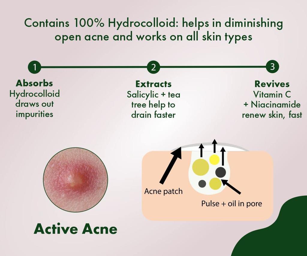 Urban Yog Acne Pimple Patch - Invisible Facial Stickers Cover with 100% Hydrocolloid, Pimple Patches for Face (Circular 36 Dots)