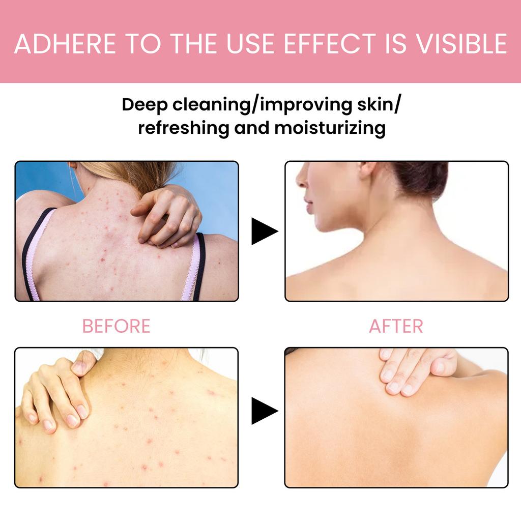 EELHOE Carbon Mud Bath Soap Bar Mineral Mud Volcano Mud Soap Bath Soap Whitening Soap Hydrating Cleaning Get Rid of Blackheads