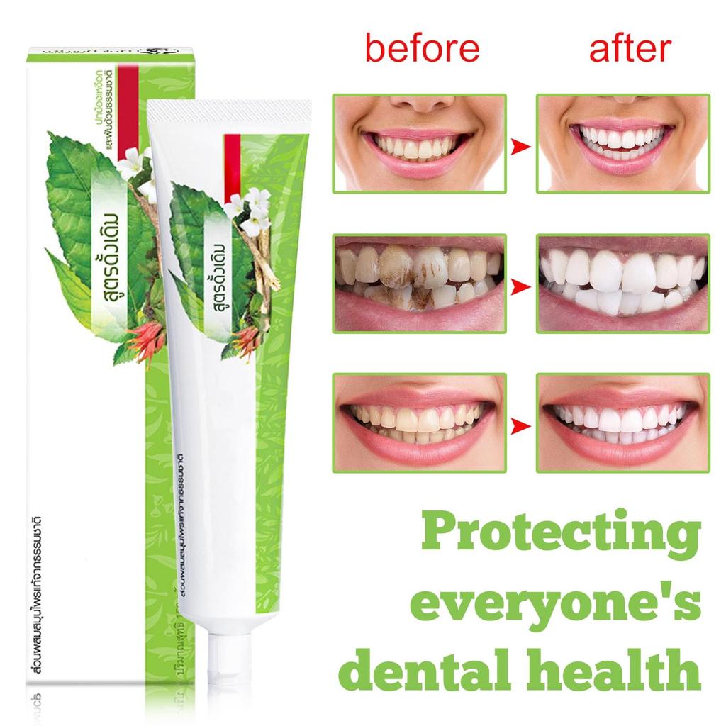 Зубная паста Shuanglian Herbal очищает желтые пятна на зубах, освежает десны и зубы 150 г