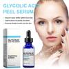 Glycolic Peel Serum,Facial Serum,Facial Care Serum,improve Skin Moderate Ability,light Texture,penetrate Deeply Into The Skin,30ml