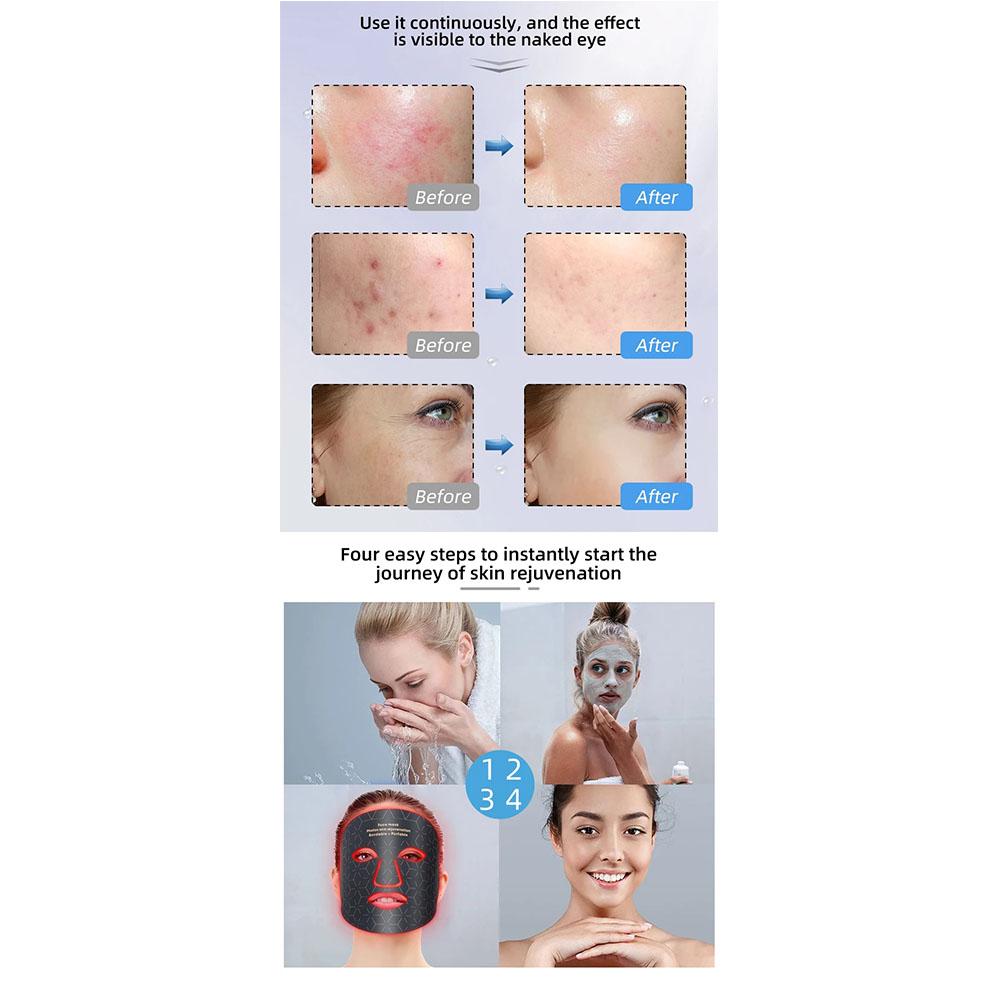 4-цветная светодиодная маска для лица с 240 шариками фотонной терапии, контроль жирности и осветление кожи, уменьшение морщин и лечение акне для омоложения лица