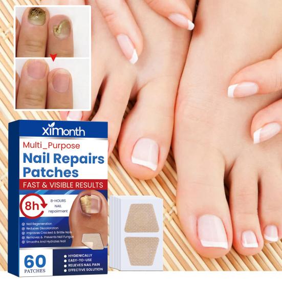 60Pcs/Box Nail Repair Patches Nail Repair Treatment Restores Damaged Nails and Appearance