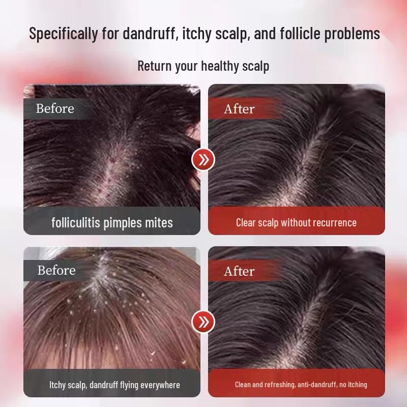 Tongrentang Selenium Disulfide Anti-Dandruff & Oil Control Shampoo