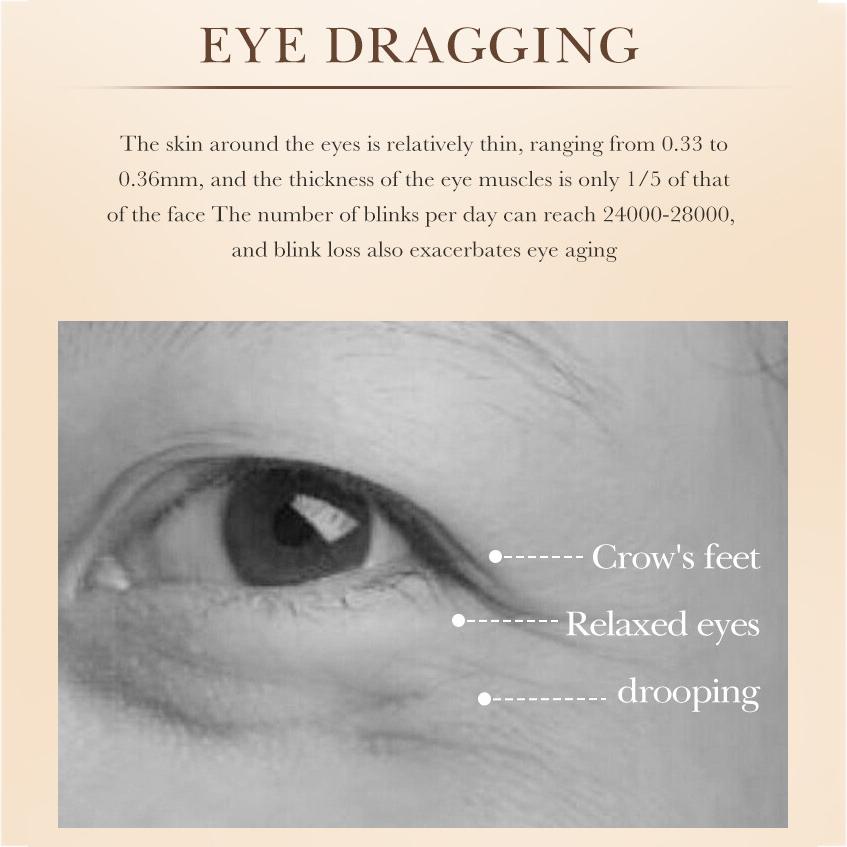 Caviar Gold Sodium Hyaluronate Rose Aloe Vera Eye Cream Lightens Dark Circles Removes Reduces Eye Bags Big Eyes Bright Eyes Eye Cream