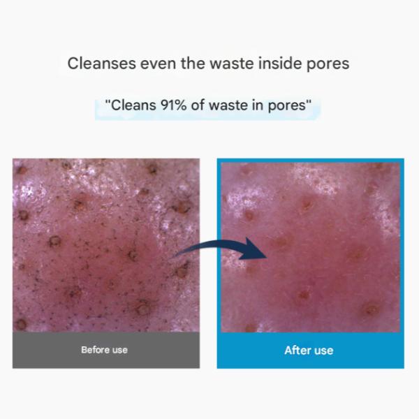 TORRIDEN DIVE-IN Очищающая пенка с низкомолекулярной гиалуроновой кислотой (150 мл / 5,07 жидких унций.) (3 варианта)