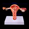 Pathological Uterus Ovary Anatomical Model Anatomy Cross Section Study Tool