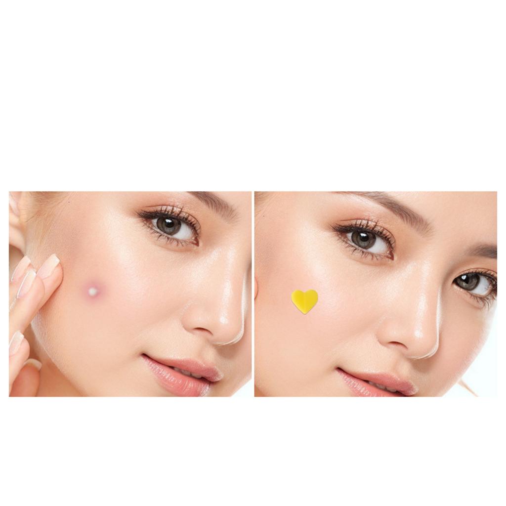 Пластырь от прыщей, пластырь от прыщей, салициловое масло, видимый водонепроницаемый, день и ночь, два в одном, пластырь от прыщей, в форме звезды