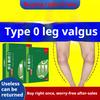 O-shaped Leg Braces Stick Loop Legs Calf Eversion Leg Type Leg Bend Xo Inner Leg Eight-character Leg Foot