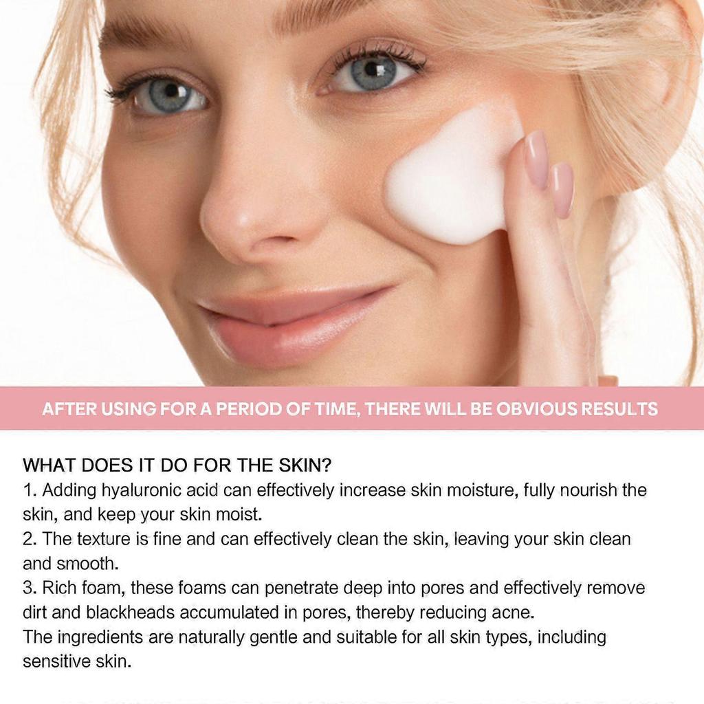 Limited time!!Jaysuing 5-In-1 Cleansing Mousse - Cleans Pores, Reduces Acne Marks, Removes Blackheads And Pimples, Controls Oil