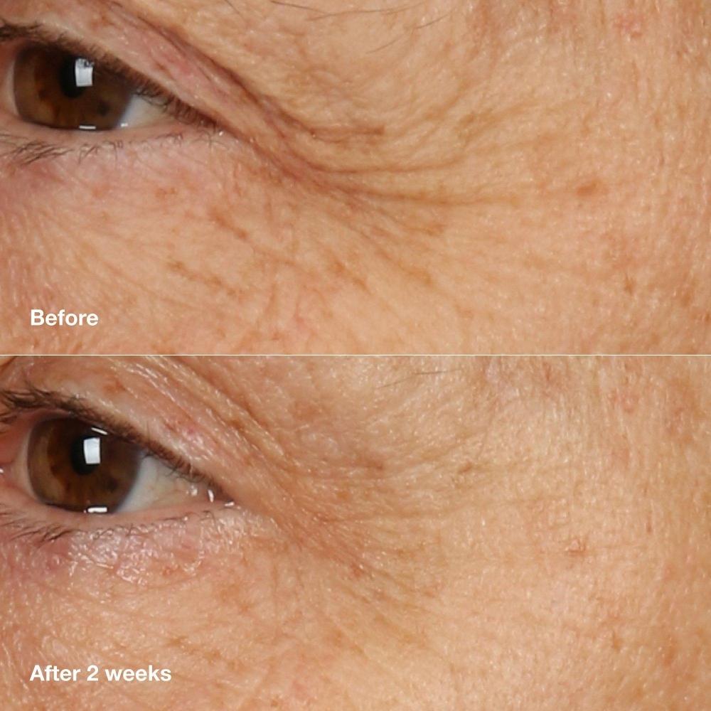 Clinique Clinique Smart Clinical Repair Ночной восстанавливающий крем + маска 1,7 унции