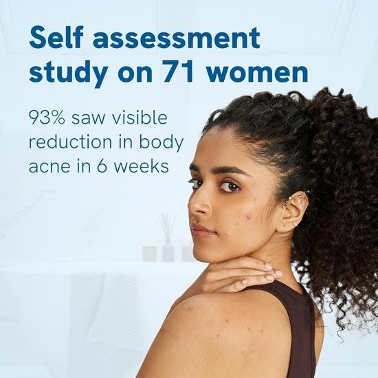 Гель для душа Be Bodywise с 1% салициловой кислотой 500 мл | Помогает предотвратить появление прыщей на теле и очищает кожу | Не содержит парабенов и SLS | Упаковка из 2 шт.