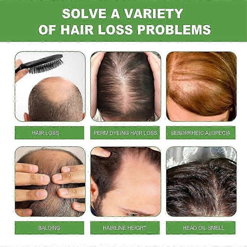 Rosemary Shampoo for Hair Growth Treatment, Stimulates Healthy Hair, Anti-Hair Loss, Natural Plant Extract, for Men and Women