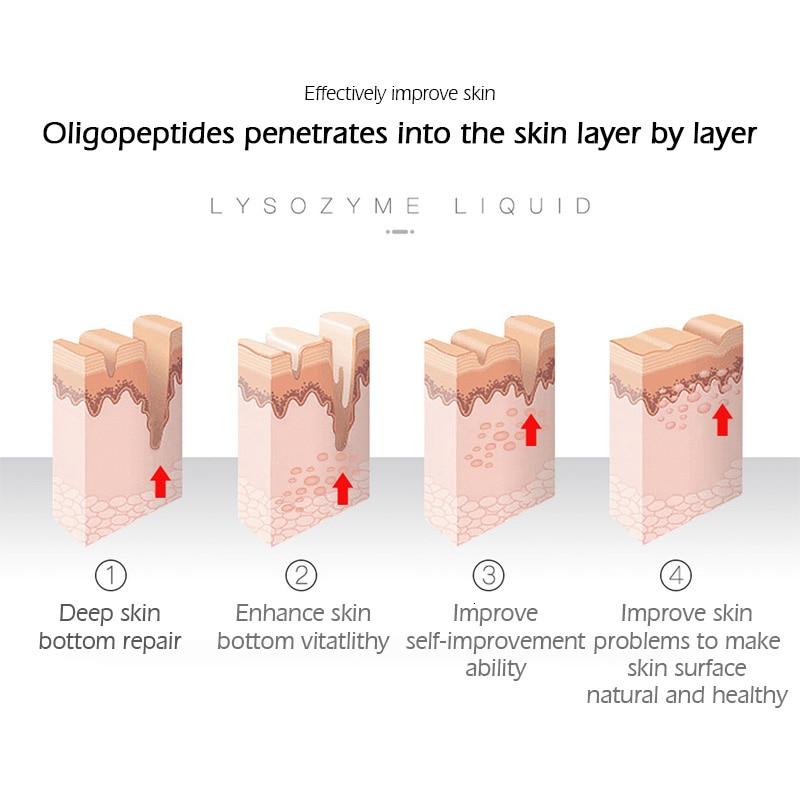 SENANA Пептидная лиофилизированная пудра, сыворотка от прыщей, лечение прыщей, увлажняющее отбеливание, против морщин, питание, уход за кожей