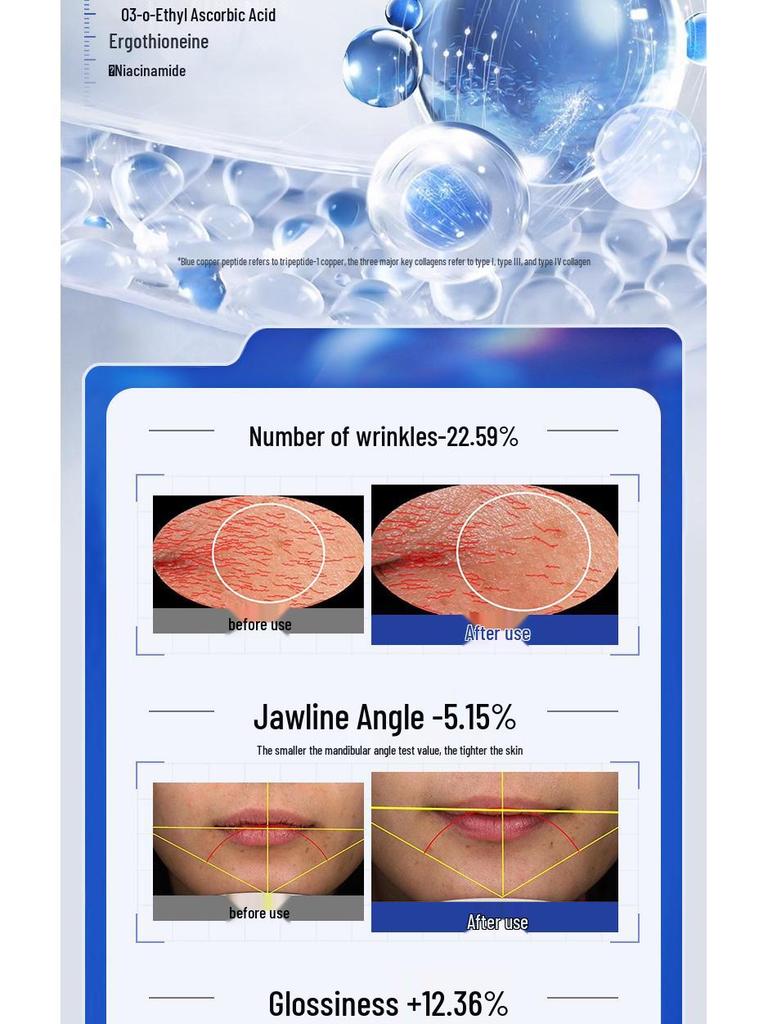 Успокаивающий набор Opeilan с сапфиром для кожи: Увлажняющий подарок из шести предметов на День матери.