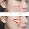 V-Lift Face Device: Firms, Lifts Sagging Skin & Diminishes Lines