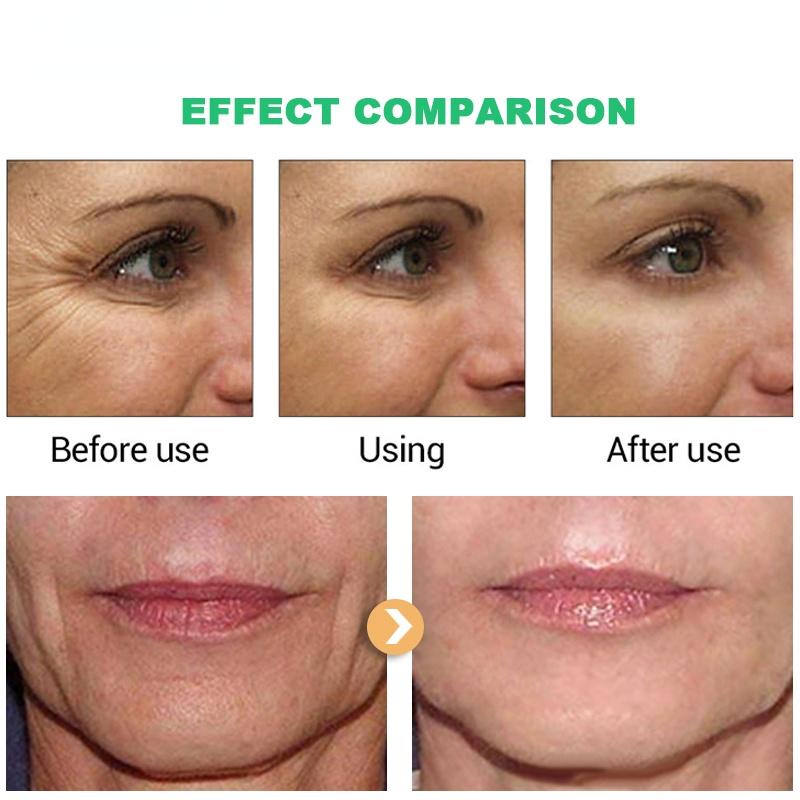 5 секунд для удаления морщин, мгновенный антивозрастной крем для лица, подтягивающий, укрепляющий кожу