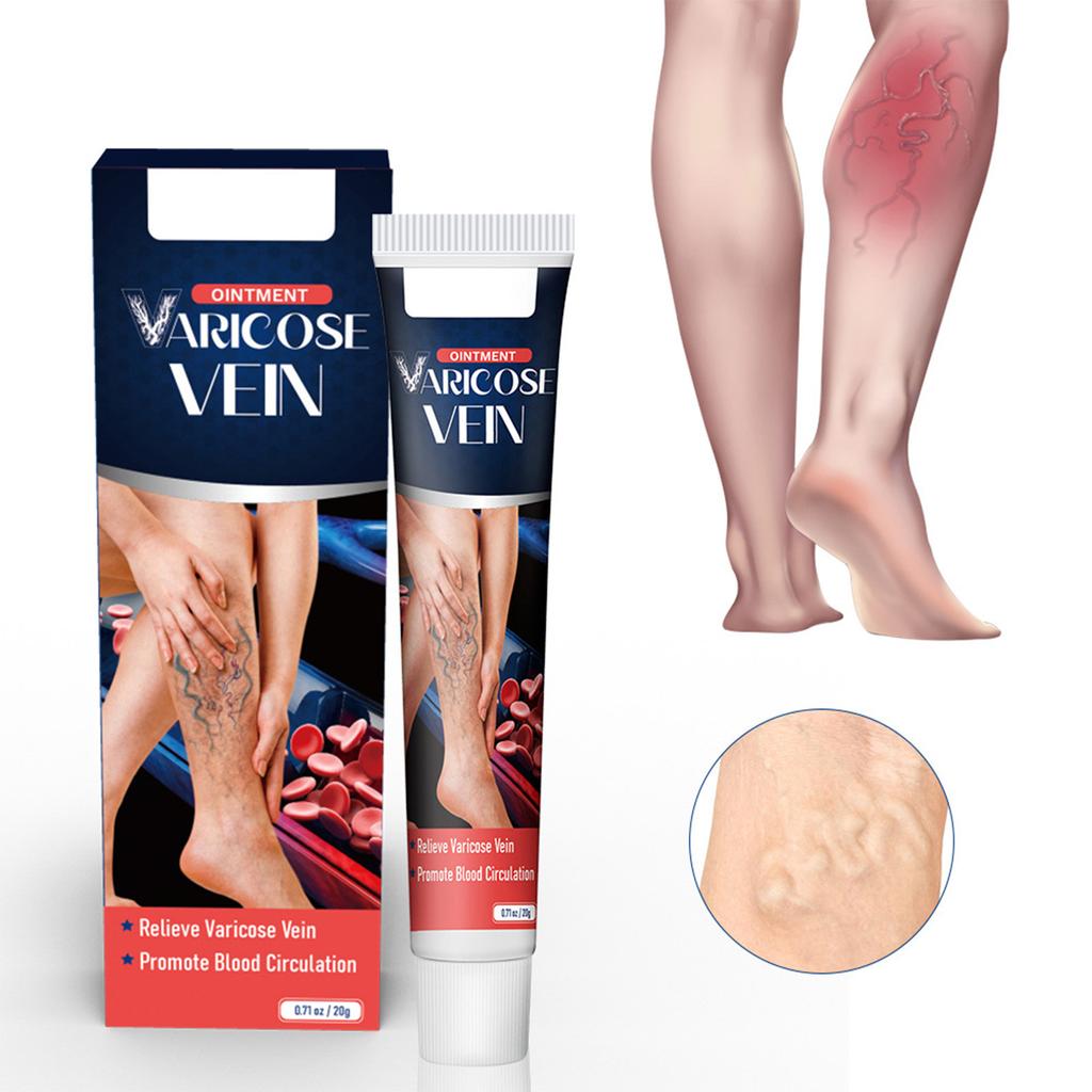 Vein Care Cream Mai Li Shu Ointment Earthworm Legs Spider Varicose Veins 20g