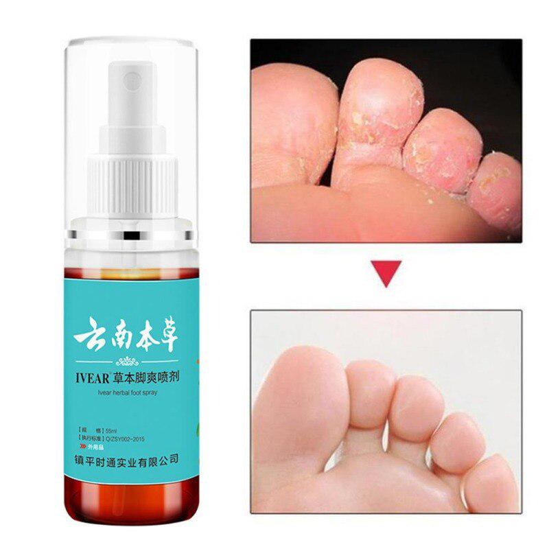 Противогрибковый спрей для ухода за ногами, травяной противогрибковый спрей для ног спортсмена, антибактериальный дезодорант, порошок, против зуда, запаха пота