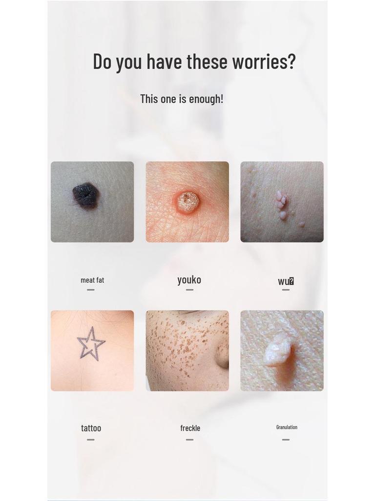 Ультрапикосекундный лазер для удаления веснушек и родинок: Портативный «Всё в одном» для домашнего и салонного использования