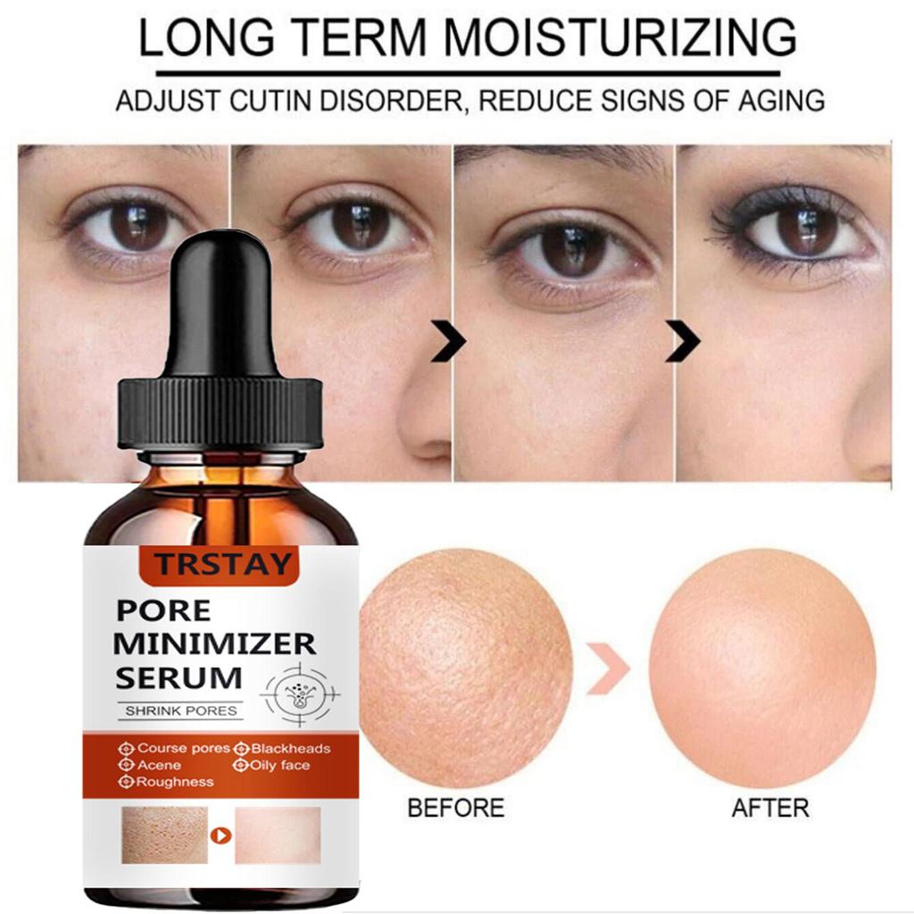 Vitamin C Retinol Firming Serum, Firming Lifting Essence, Softens Skin, Improves Elasticity,  Smoothes Wrinkles, Skin Care Face Serum For Women