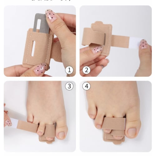 Hammer Toe Wraps, Orthotics, Toe Bandage Protectors for Broken Toes, Overlapped Toes, Curved Toes, and Bunion Alignment, Reusable Fabric Buddy Wraps,