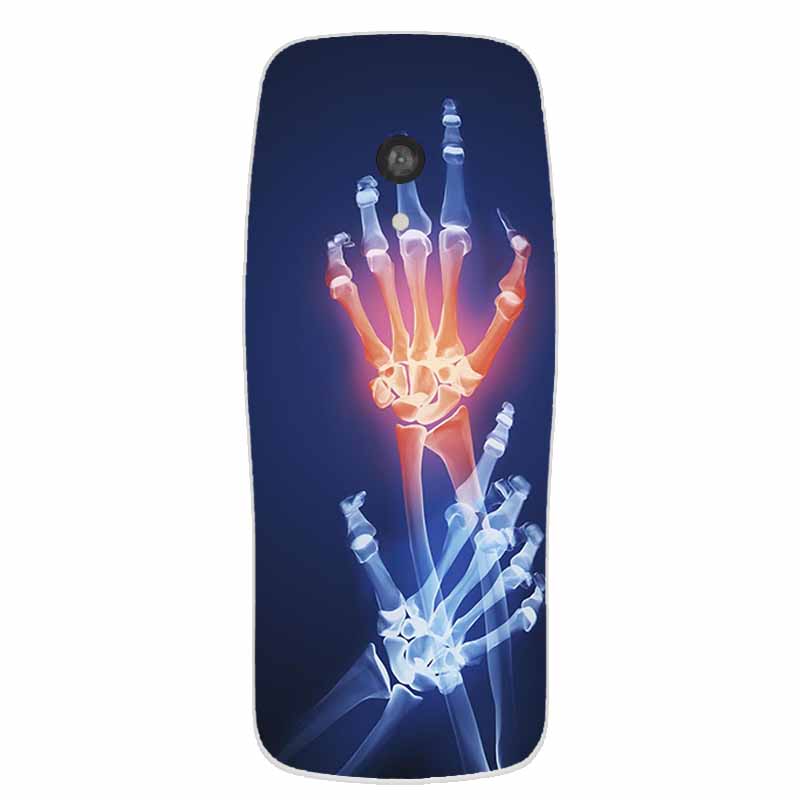 Чехол из ТПУ для Nokia 3210 2024 Чехол 2,4" Coque Прозрачный Силиконовый Мягкий Прозрачный Задний Чехол Для Nokia 3210 Чехол Для Телефона Funda Shell