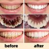 100g Whitening Toothpaste Remover Dental Calculus Whitening Teeth Mouth Odor Removal Bad Breath Preventing Periodontitis