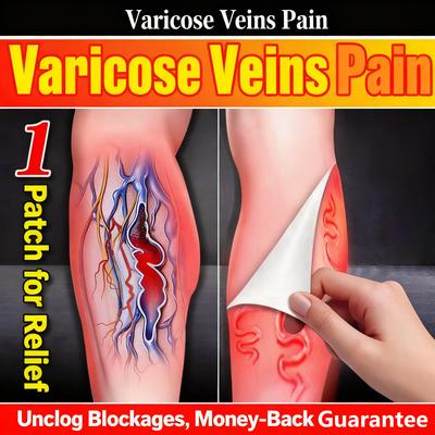 Варикозное расширение вен Шу пластырь стик лечение ноги земляного червя при сосудистой закупорке прочистка ноги выпирающие синие вены специальный гель для холодных компрессов