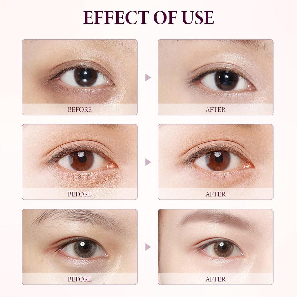 Увлажняющий крем для век. Увлажнение и увлажнение кожи вокруг глаз. Освежающий и нежный крем для лица.