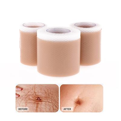 Силиконовый гель пластырь для лечения шрамов удаление пластыря покрытие ожог травма ремонт акне шрам от ушей раздел красота кожи