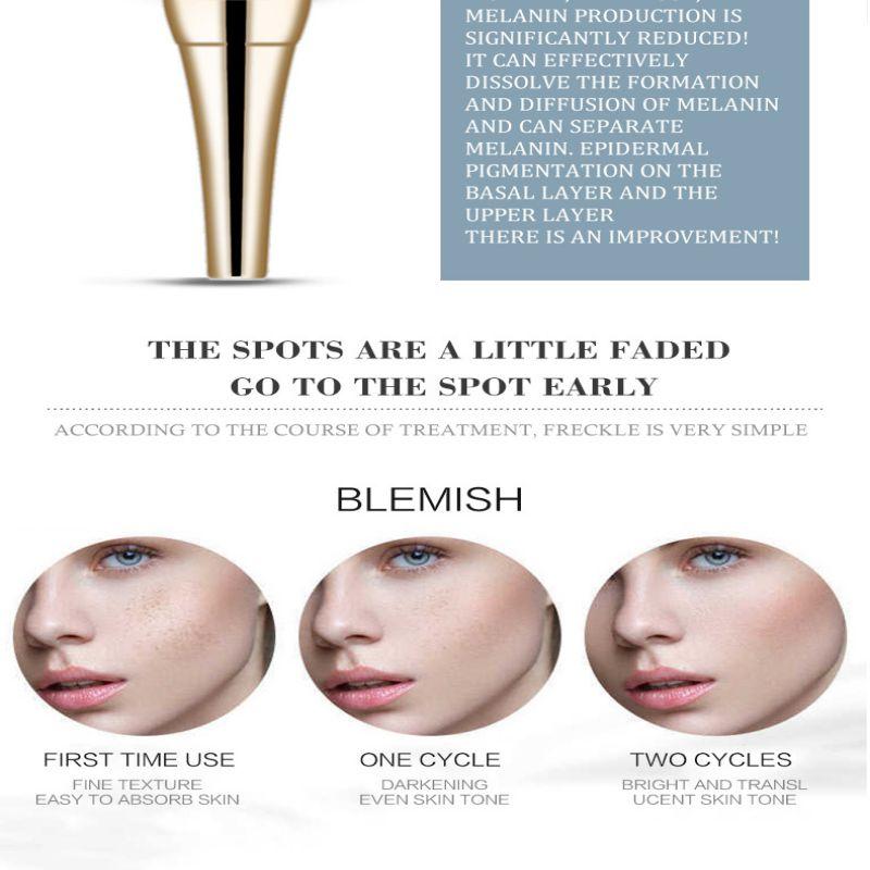 Крем против пятен, питающий кожу, увлажняющий, лифтинг, укрепляющая косметика, удаление веснушек, прыщей, пигмента, меланина, крем для лица