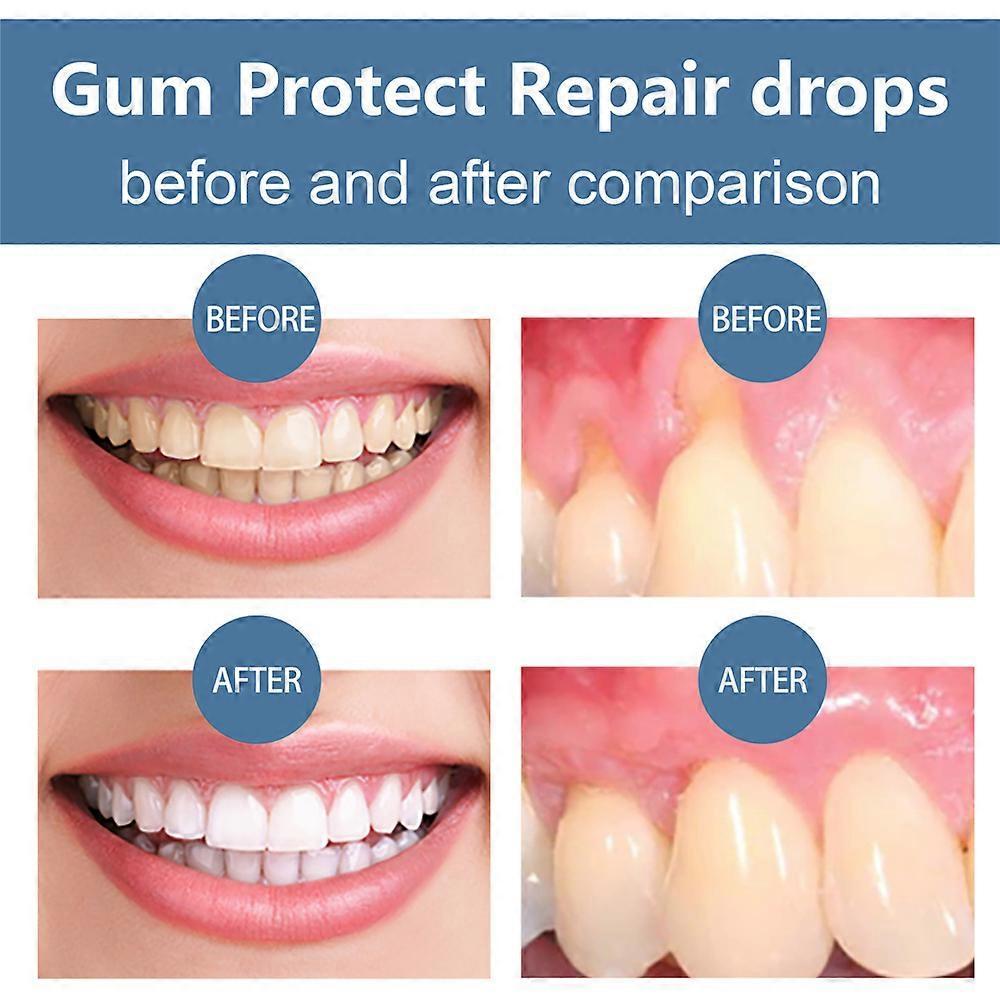 Natural Gum Restore Plus Liquid Drops Mouthwash,Gum Regrowth Drops,Receding Gum Treatment for Gum Health,Gum Repair for Receding Gums Fresh Breath,Gum