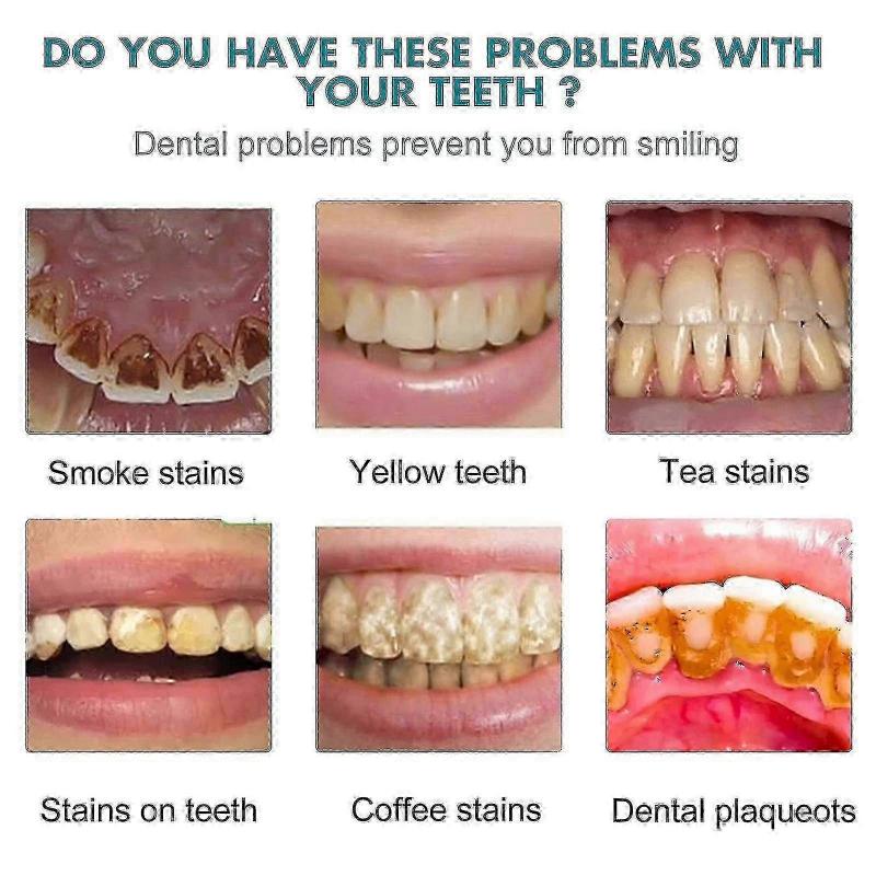 Гель для отбеливания зубов, Полировка для зубов, Мгновенная отбеливающая краска для зубов, Безопасно и эффективно для чувствительных зубов -7340052400520