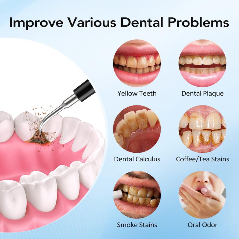 Electric Tooth Cleaner Dental Scaler Calculus Remover Sonic Vibration Toothbrush Plaque Tartar Removal Teeth Whitening Cleaning