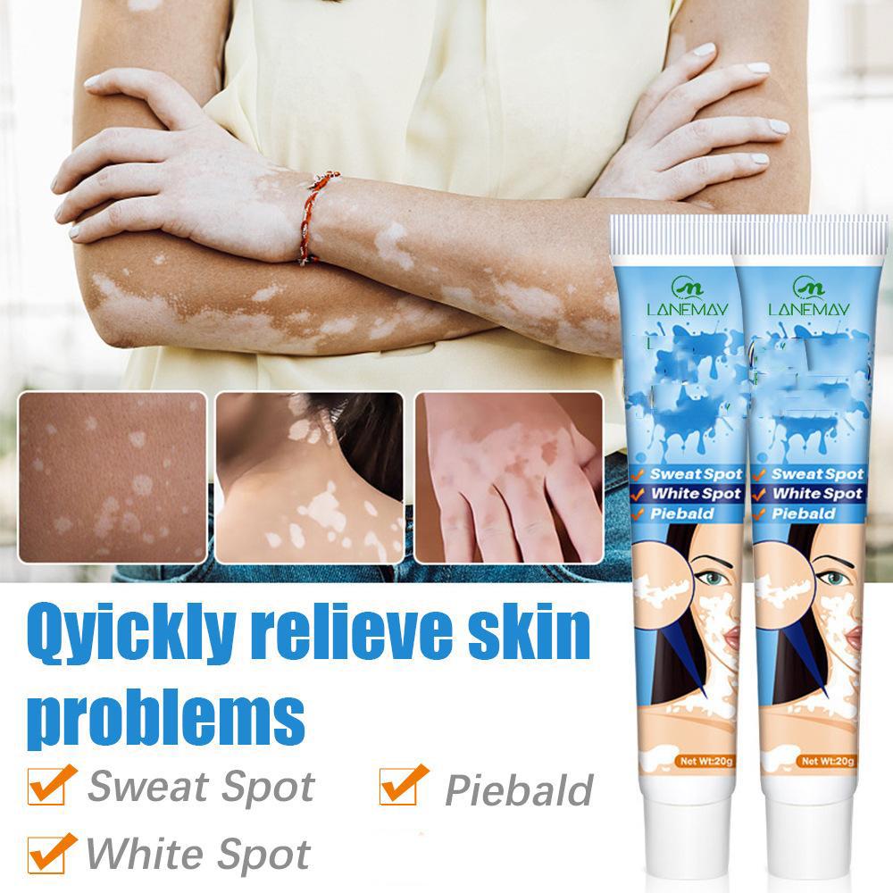 Кремы для лица Лосьоны Болезни Кремы и лосьоны для лица Кремы и лосьоны для лица Кремы и лосьоны для лица Болезни Крем от белых пятен 20г