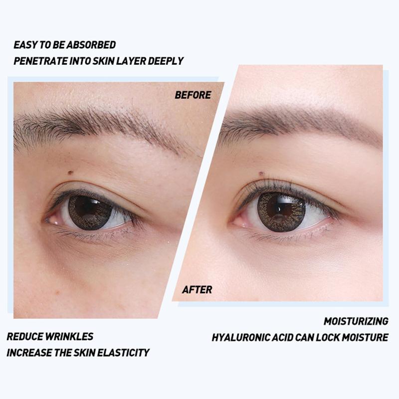 Увлажняющая сыворотка для глаз Удаляет темные круги и уменьшает тонкие линии Нежная питательная сыворотка для ухода за глазами