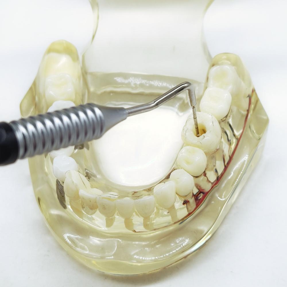 1 шт. Нити Дентал Ручные Плаггеры для корневых каналов Вертикальная обтурация Эндодонтический ручной плаггер Инструмент Дентальный спредер Стоматология Вертикальный плаггер