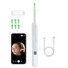 Mahousky Earpick Camera, Ear Cleaning, Earpick, 5 Megapixels, 1080P, 3.5mm Ultra-Small Lens, Illuminated Earpick, Earscope, Earwax Removal, Wireless,