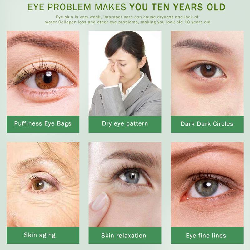 ARTISCARE Seaweed Eye Patches/Mask 60pcs Anti-Puffiness Dark Circles Moisturizing Eyes Care