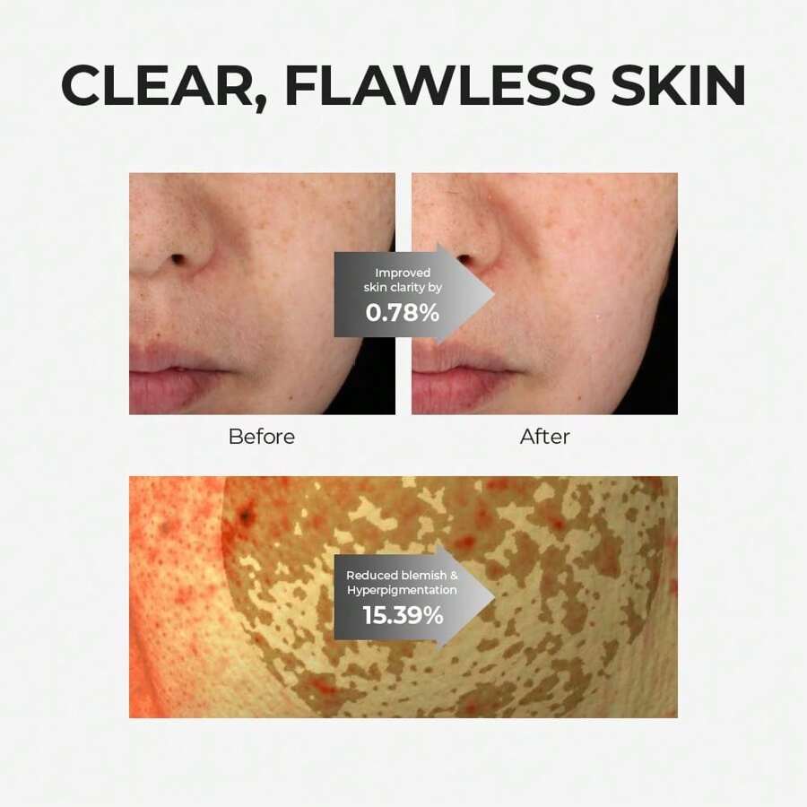 Skin&Lab Glutathione Ampoule Toner 200ml , Improve Dart Spot, Hyperpigmented, Skin Clarity, Korean Toner For Sensitive Skin