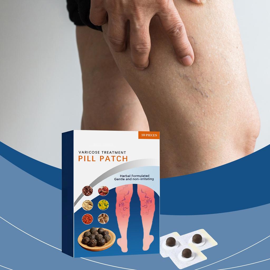 Varicose Vein Patch Vasculitis Phlebitis Vascular Swelling Best Teatment Ointment Skin Care Patch 10 Pieces